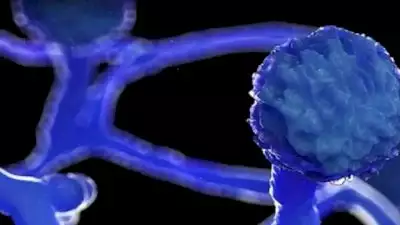 ബ്ലാക്ക് ഫംഗസ് ബാധ; മുംബൈയില്‍ മൂന്നുകുട്ടികളുടെ കണ്ണ് നീക്കം ചെയ്തു, ആശങ്ക