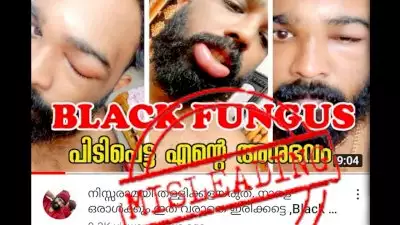 ബ്ലാക്ക് ഫംഗസ് എന്ന് തെറ്റിദ്ധരിച്ച് തെറ്റായ ചികിത്സകള്‍ക്കും ചൂഷണങ്ങള്‍ക്കും വിധേയമാകാതിരിക്കുക, കുറിപ്പ്