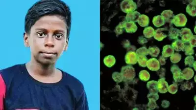 അമീബിക് മസ്തിഷ്‌കജ്വരം ബാധിച്ച് വീണ്ടും മരണം; കോഴിക്കോട് ഏഴാം ക്ലാസ് വിദ്യാര്‍ത്ഥി മരിച്ചു