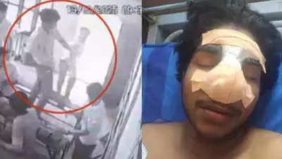 ഒറ്റപ്പാലത്തെ സ്വകാര്യ ഐടിഐയിൽ സഹപാഠിയുടെ മർദ്ദനത്തിൽ വിദ്യാർത്ഥിയുടെ മൂക്കിൻ്റെ എല്ല് പൊട്ടി; കേസെടുത്ത് പൊലീസ്