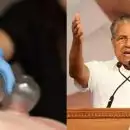 'അശാസ്ത്രീയത പ്രചരിപ്പിക്കുന്നവർ സാമൂഹ്യദ്രോഹികൾ'; അക്യുപങ്ങ്ചർ ചികിത്സയ്ക്കെതിരെ മുഖ്യമന്ത്രി