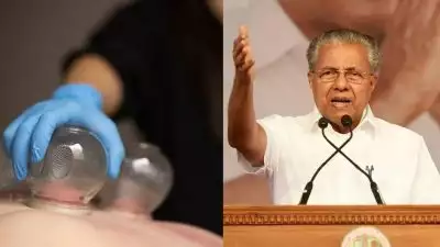 'അശാസ്ത്രീയത പ്രചരിപ്പിക്കുന്നവർ സാമൂഹ്യദ്രോഹികൾ, ഇവർക്കെതിരെ സമൂഹം ഒറ്റക്കെട്ടായി നിൽക്കണം'; അക്യുപങ്ങ്ചർ ചികിത്സയ്ക്കെതിരെ മുഖ്യമന്ത്രി