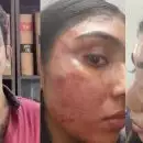 'വാക്കുതർക്കം, സീനിയർ അഭിഭാഷകൻ മോപ് സ്റ്റിക് കൊണ്ട് മർദ്ദിച്ചു'; പരാതിയുമായി ജൂനിയർ അഭിഭാഷക രംഗത്ത്