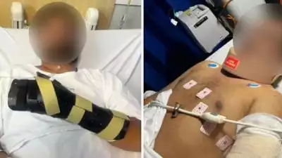 ഇന്ത്യൻ വംശജന് നേരെ ഓസ്‌ട്രേലിയയിൽ ആക്രമണം; കൈ ഒടിഞ്ഞു, ഗുരുതര പരിക്ക്