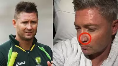 ഓസ്‌ട്രേലിയൻ ഇതിഹാസം മൈക്കൽ ക്ലാർക്കിന് സ്കിൻ കാൻസർ സ്ഥിരീകരിച്ചു