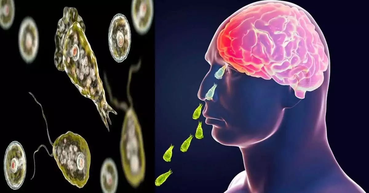 'അമീബിക്ക് മസ്തിഷ്ക ജ്വരം ബാധിച്ച് സംസ്ഥാനത്ത് ഈ വർഷം മരിച്ചത് 17 പേർ, 66 പേർക്ക് രോഗം ബാധിച്ചു'; കണക്കുകളിൽ വ്യക്തത വരുത്തി ആരോഗ്യവകുപ്പ്