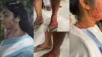 പ്രാണി 'കടിച്ച' റിമയുടെ ശരീരം ഇങ്ങനെ..; മേക്കപ്പ് വീഡിയോ ചര്‍ച്ചയാകുന്നു