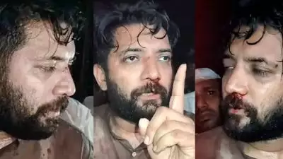 പൊലീസ് മർദനത്തിൽ പരിക്കേറ്റ ഷാഫി പറമ്പിലിനെതിരെ കേസ്: പൊലീസിനെ ആക്രമിച്ചെന്ന് എഫ്ഐആർ, 692 കോൺഗ്രസ് പ്രവർത്തകർക്കെതിരെ നടപടി