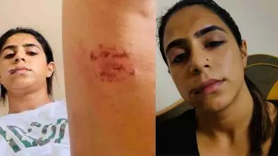 മേല്‍ചുണ്ട് കീറിപ്പോയി, കക്ഷത്തും തുടകളിലും കടിച്ചു.. മുന്‍ പങ്കാളിയുടെ ഞെട്ടിക്കുന്ന പീഡനങ്ങള്‍; വെളിപ്പെടുത്തലുമായി നടി ജസീല