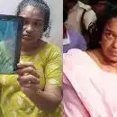 വയറ്റില്‍ കത്രിക കുടുങ്ങിയതില്‍ പിഴവ് സമ്മതിച്ച് ആശുപത്രി അധികൃതര്‍; സ്വമേധയാ കേസെടുത്ത് മനുഷ്യാവകാശ കമ്മീഷൻ, ഉഷയുടെ ശസ്ത്രക്രിയ നാളെ