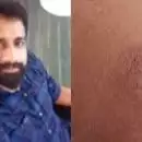 കണ്ണൂരില്‍ കിണര്‍ പണിക്കിടെ സൂര്യാഘാതമേറ്റ് യുവാവ് മരിച്ചു; കേന്ദ്ര കാലാവസ്ഥ വകുപ്പിന്റെ ഉഷ്ണതരംഗ സാധ്യത മുന്നറിയിപ്പ്, എല്ലാ ജില്ലകളിലും ജാഗ്രത പാലിക്കണമെന്ന് ദുരന്ത നിവാരണ അതോറിറ്റി