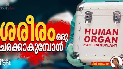 ആഗോള അവയവവിപണി, ദാരിദ്ര്യം, തൊഴിലാളി ചൂഷണം